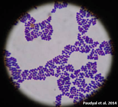 View of Staphylococcus aureus through the microscope, after Gram-stain.